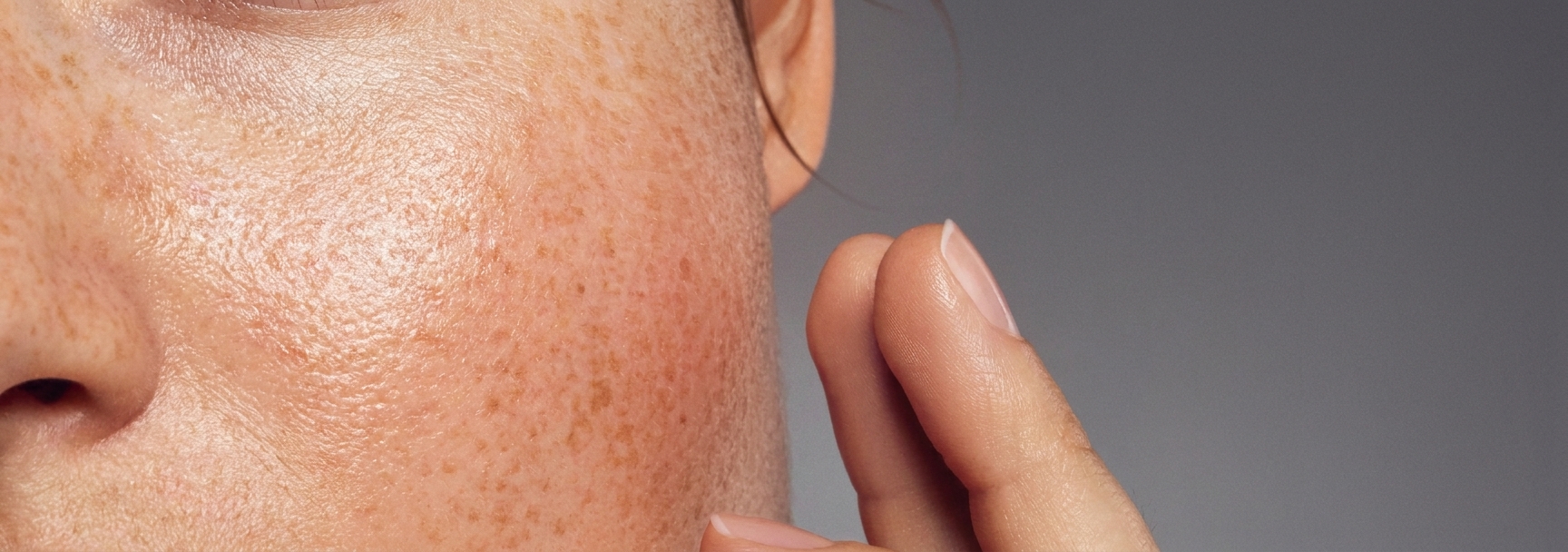 چه زمانی در خودبررسی پوست باید به پزشک مراجعه کنیم؟